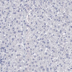 Invitrogen CEP170B Polyclonal Antibody 100 &mu;L; Unconjugated:Antibodies,