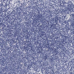 Invitrogen CEP170B Polyclonal Antibody 100 &mu;L; Unconjugated:Antibodies,