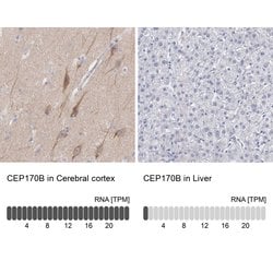 Invitrogen CEP170B Polyclonal Antibody 100 &mu;L; Unconjugated:Antibodies,