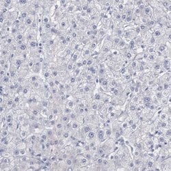 Invitrogen CEP170B Polyclonal Antibody 100 &mu;L; Unconjugated:Antibodies,