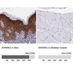 Invitrogen AHNAK2 Polyclonal Antibody 100 &mu;L; Unconjugated:Antibodies,