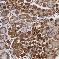 Invitrogen FRMD7 Polyclonal Antibody 100 &mu;L; Unconjugated:Antibodies,