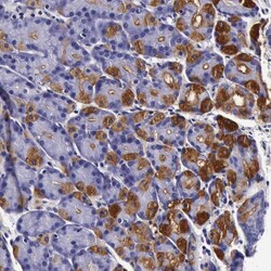 Invitrogen CCDC22 Polyclonal Antibody 100 &mu;L; Unconjugated:Antibodies,