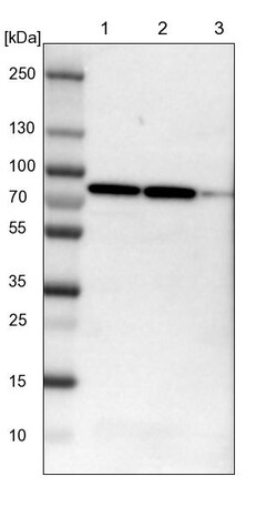 Invitrogen CCDC22 Polyclonal Antibody 100 &mu;L; Unconjugated:Antibodies,