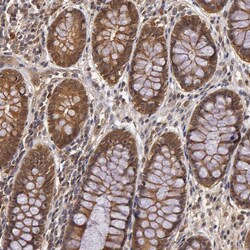 Invitrogen AHA1 Polyclonal Antibody 100 &mu;L | Buy Online | Invitrogen&trade; | Fisher Scientific