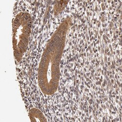 Invitrogen AHA1 Polyclonal Antibody 100 &mu;L | Buy Online | Invitrogen&trade; | Fisher Scientific