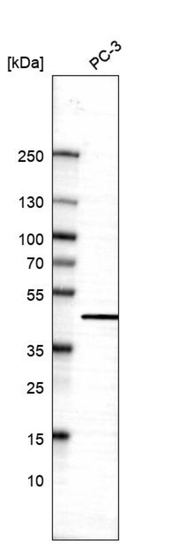 Invitrogen AHA1 Polyclonal Antibody 100 &mu;L | Buy Online | Invitrogen&trade; | Fisher Scientific