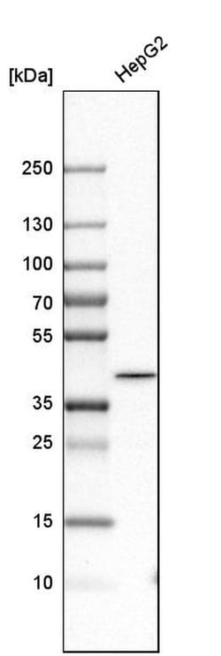 Invitrogen GMPR2 Polyclonal Antibody 100 &mu;L; Unconjugated:Antibodies,