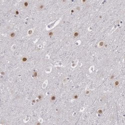 Invitrogen NKAP Polyclonal Antibody 100 &mu;L; Unconjugated:Antibodies,