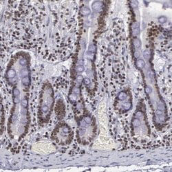 Invitrogen NKAP Polyclonal Antibody 100 &mu;L; Unconjugated:Antibodies,