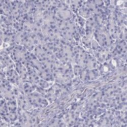 Invitrogen THSD7A Polyclonal Antibody 100 &mu;L; Unconjugated:Antibodies,