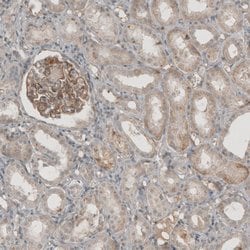 Invitrogen THSD7A Polyclonal Antibody 100 &mu;L; Unconjugated:Antibodies,