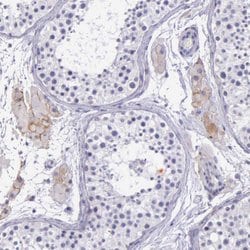 Invitrogen THSD7A Polyclonal Antibody 100 &mu;L; Unconjugated:Antibodies,