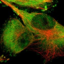 Invitrogen PYGL Polyclonal Antibody 100 &mu;L; Unconjugated:Antibodies,