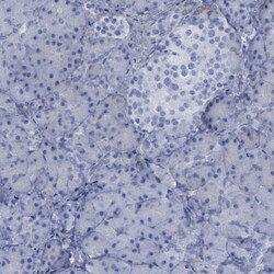 Invitrogen PYGL Polyclonal Antibody 100 &mu;L; Unconjugated:Antibodies,