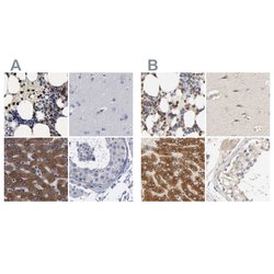 Invitrogen PYGL Polyclonal Antibody 100 &mu;L; Unconjugated:Antibodies,