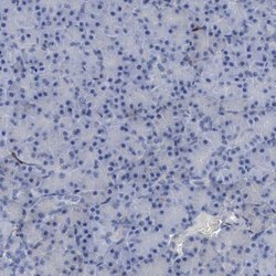 Invitrogen PYGL Polyclonal Antibody 100 &mu;L; Unconjugated:Antibodies,