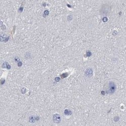 Invitrogen PYGL Polyclonal Antibody 100 &mu;L; Unconjugated:Antibodies,