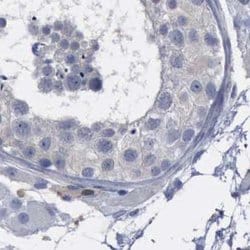Invitrogen PYGL Polyclonal Antibody 100 &mu;L; Unconjugated:Antibodies,