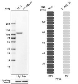 Invitrogen PYGL Polyclonal Antibody 100 &mu;L; Unconjugated:Antibodies,