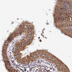 Invitrogen PRICKLE3 Polyclonal Antibody 100 &mu;L; Unconjugated:Antibodies,
