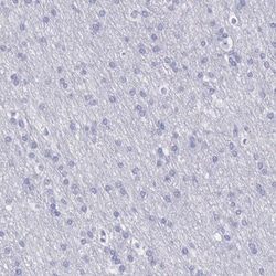 Invitrogen Cystatin A Polyclonal Antibody 100 &mu;L; Unconjugated:Antibodies,