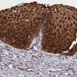 Invitrogen Cystatin A Polyclonal Antibody 100 &mu;L; Unconjugated:Antibodies,