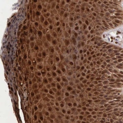 Invitrogen Cystatin A Polyclonal Antibody 100 &mu;L; Unconjugated:Antibodies,