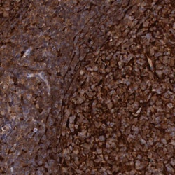 Invitrogen Cystatin A Polyclonal Antibody 100 &mu;L; Unconjugated:Antibodies,