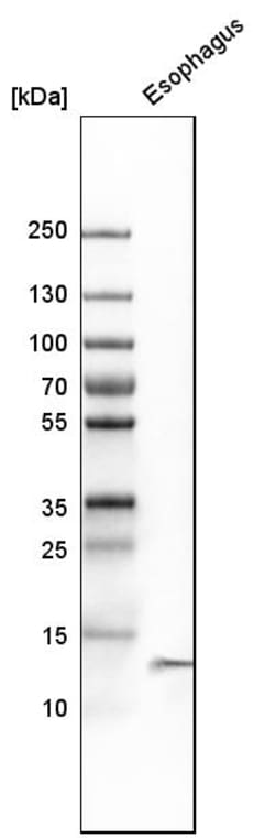 Invitrogen Cystatin A Polyclonal Antibody 100 &mu;L; Unconjugated:Antibodies,