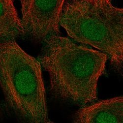 Invitrogen Cystatin A Polyclonal Antibody 100 &mu;L; Unconjugated:Antibodies,