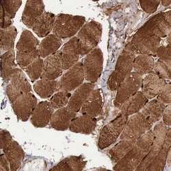 Invitrogen FHL1 Polyclonal Antibody 100 &mu;L; Unconjugated:Antibodies,