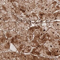 Invitrogen FHL1 Polyclonal Antibody 100 &mu;L; Unconjugated:Antibodies,