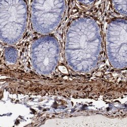 Invitrogen FHL1 Polyclonal Antibody 100 &mu;L; Unconjugated:Antibodies,