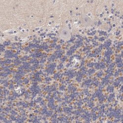 Invitrogen KV4.1 (KCND1) Polyclonal Antibody 100 &mu;L; Unconjugated:Antibodies,