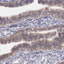 Invitrogen KV4.1 (KCND1) Polyclonal Antibody 100 &mu;L; Unconjugated:Antibodies,