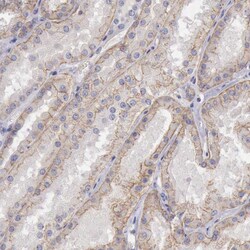 Invitrogen KV4.1 (KCND1) Polyclonal Antibody 100 &mu;L; Unconjugated:Antibodies,