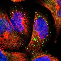 PHKA1 Polyclonal Antibody:Antibodies, Polyclonal