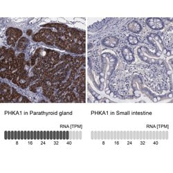 PHKA1 Polyclonal Antibody:Antibodies, Polyclonal