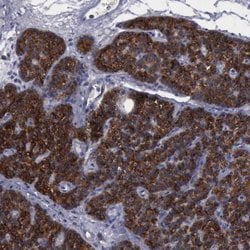 PHKA1 Polyclonal Antibody:Antibodies, Polyclonal