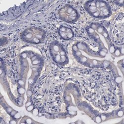 PHKA1 Polyclonal Antibody:Antibodies, Polyclonal