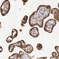 Invitrogen GPR101 Polyclonal Antibody 100 &mu;L; Unconjugated:Antibodies,