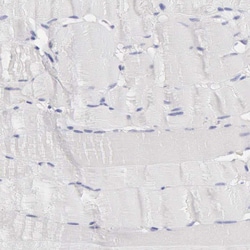 Invitrogen SASH3 Polyclonal Antibody 100 &mu;L | Buy Online | Invitrogen&trade; | Fisher Scientific