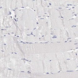 Invitrogen SASH3 Polyclonal Antibody 100 &mu;L | Buy Online | Invitrogen&trade; | Fisher Scientific