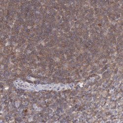 Invitrogen SASH3 Polyclonal Antibody 100 &mu;L | Buy Online | Invitrogen&trade; | Fisher Scientific