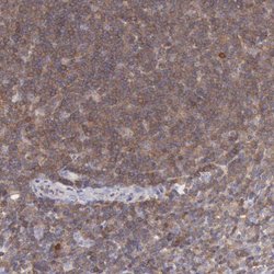 Invitrogen SASH3 Polyclonal Antibody 100 &mu;L | Buy Online | Invitrogen&trade; | Fisher Scientific