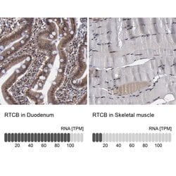 Invitrogen RTCB Polyclonal Antibody 100 &mu;L; Unconjugated:Antibodies,