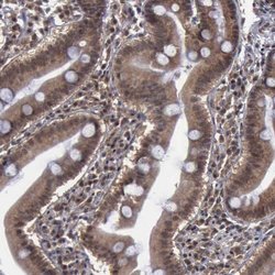 Invitrogen RTCB Polyclonal Antibody 100 &mu;L; Unconjugated:Antibodies,