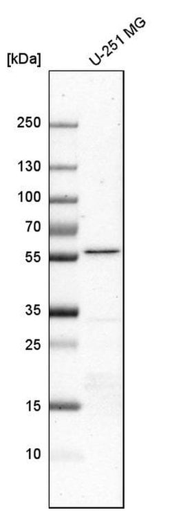 Invitrogen RTCB Polyclonal Antibody 100 &mu;L; Unconjugated:Antibodies,
