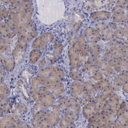 Invitrogen C14orf145 Polyclonal Antibody 100 &mu;L; Unconjugated:Antibodies,